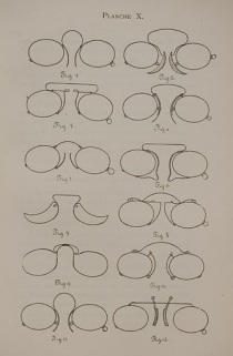Anciens modèles de pince-nez, 1913. © Région Bourgogne-Franche-Comté, Inventaire du patrimoine